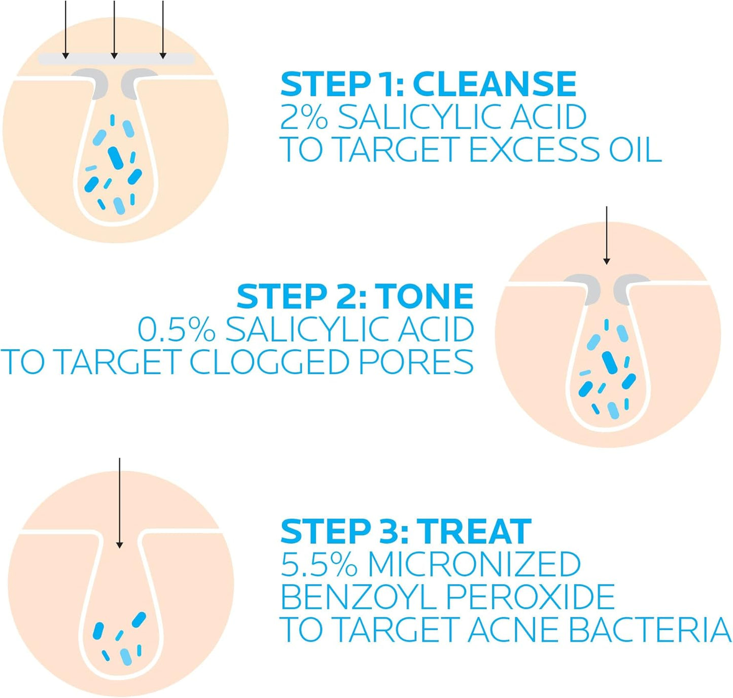 La Roche Posay Effaclar Dermatological 3 Step Acne Treatment System, Salicylic Acid Acne Cleanser, Pore Refining Toner, and Benzoyl Peroxide Acne Spot Treatment for Sensitive Skin, 2-Month Supply